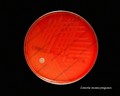 listeria monocytogenes beta-hemolysis